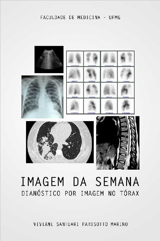 FILOSOFIA, VERSOS E DOR